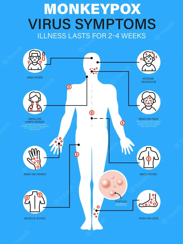Monkeypox Virus Vaccine and Side Effects – USA Health News