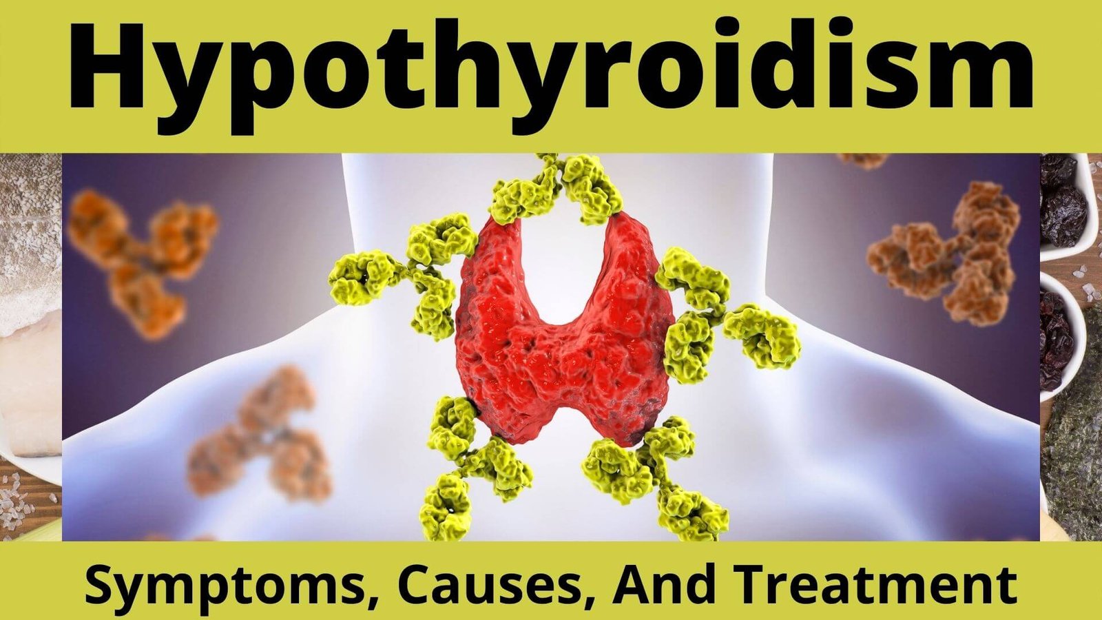 HYPOTHYROIDISM