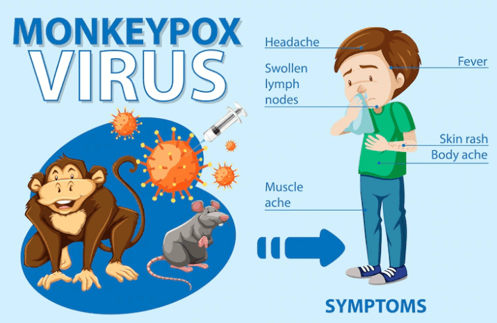 Monkeypox virus