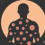MonkeyPox Virus